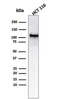 MSH2 Antibody (MSH2/6549R) - Azide and BSA Free, Novus Biologicals 100